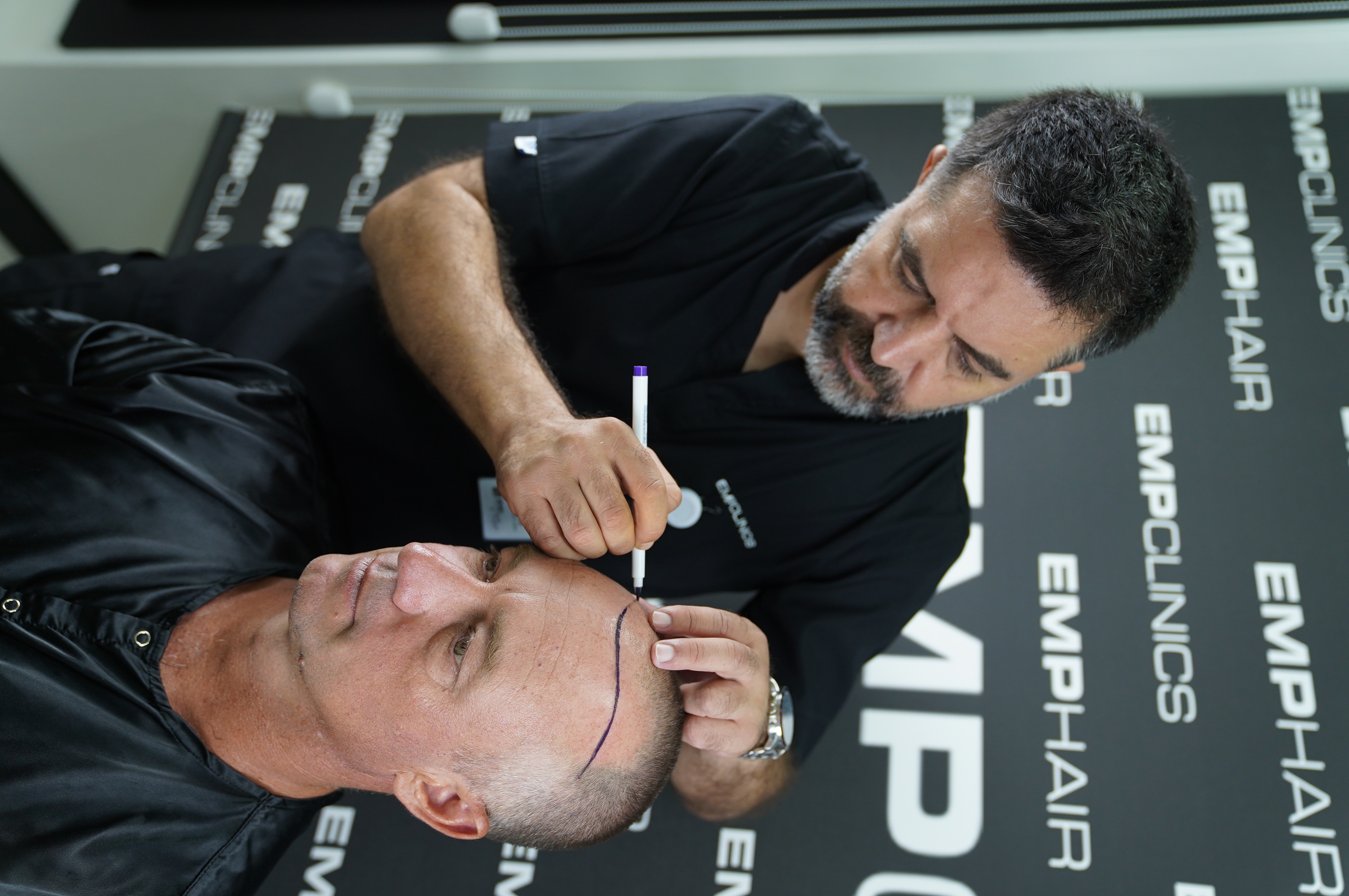 FUE Saç Ekimi