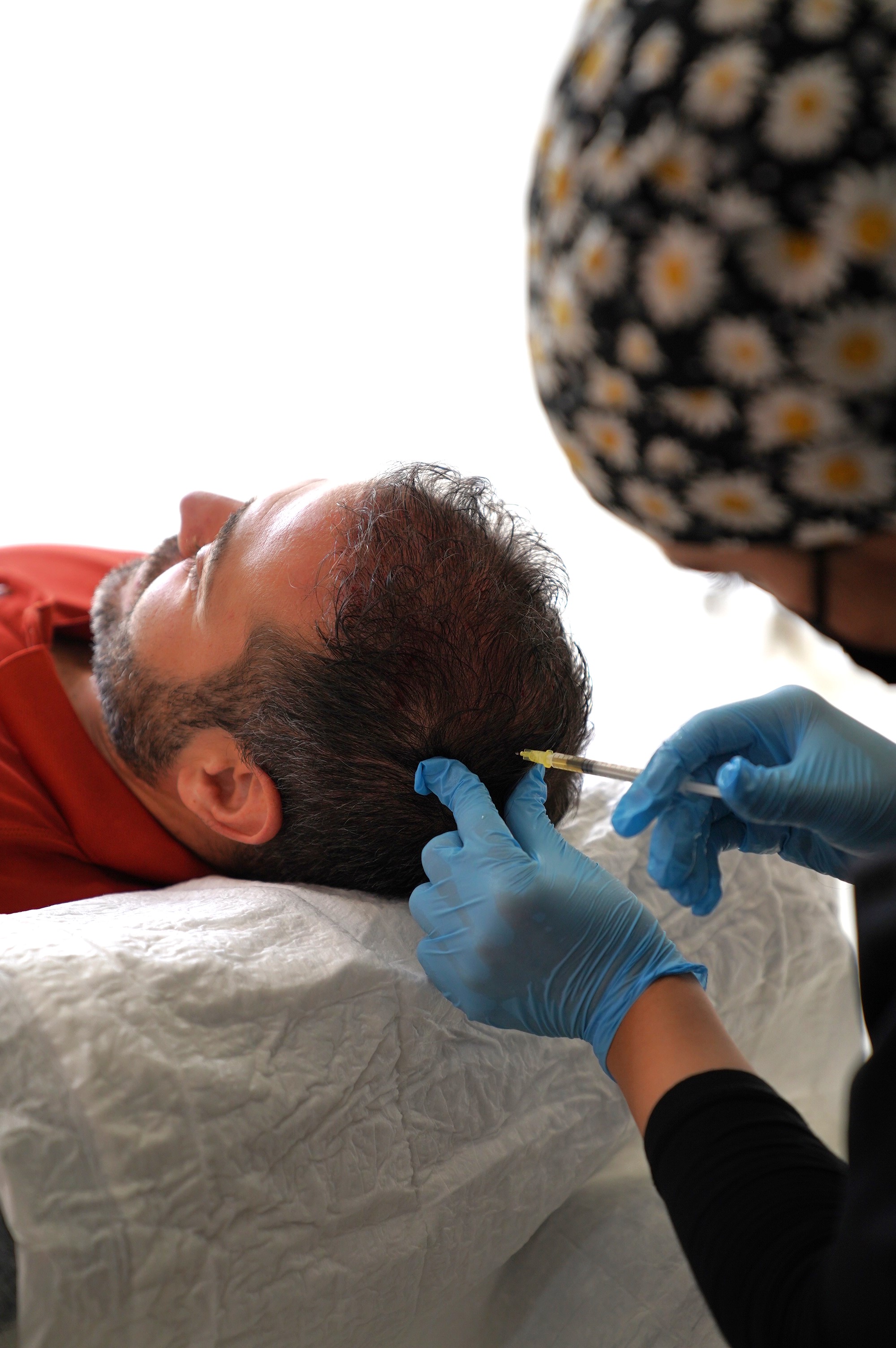 Hair Transplant Image 9
